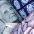 Thumbnail_20120215clin002