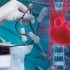 Cardiac function improves with stem cell therapy after MI