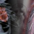 Intravascular ultrasound improves outcomes of PCI for bifurcation lesions