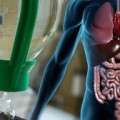 Noradrenaline a cost-effective option for type 1 hepatorenal syndrome