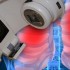Stereotactic body radiotherapy effective for solitary pulmonary nodules