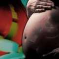 Birth defects uncommon after exposure to leflunomide