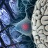 Amantadine accelerates recovery of cognition after traumatic brain injury