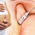 Bariatric surgery good for mom-to-be but not necessarily baby: study