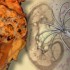 Size matters when it comes to success of RFA for renal tumors