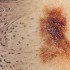Thumbnail_20120316epid004