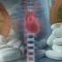 Thumbnail_20120320drgd002