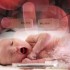 Avoid tight glycemic control in hyperglycemic preemies — for now