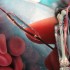 Paclitaxel-eluting balloon promising for femoropopliteal artery disease