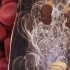 Overt hematuria always requires workup