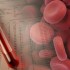 Once-daily lixisenatide effective as monotherapy for DM2