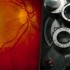 Verteporfin does not improve efficacy of ranibizumab for macular degeneration