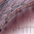 Thumbnail_20120410drgd002