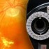 Bevacizumab efficacy in diabetic macular edema sustained at 2 years