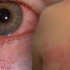 Thumbnail_20120412epid006