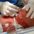 Thumbnail_20120413clin008