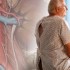 Thumbnail_20120419clin002