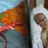 Survival better with endovascular rather than open repair of aortic aneurysm