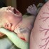 Antenatal steroids no benefit in late preterm neonates