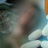 A statin before CABG has benefits: Cochrane Review