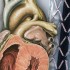 New meta-analysis confirms benefits of radial approach for PCI