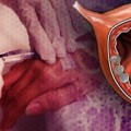 Neoadjuvant chemotherapy improves survival in urothelial cancer