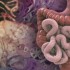 FDG-PET contributes to staging of localized gastric cancer