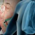 Indwelling pleural catheters no better than pleurodesis in palliating pleural effusion