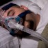 CPAP for sleep apnea may reduce incident hypertension