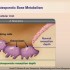 Overton-HIV Bone Health-Section2-7-H360