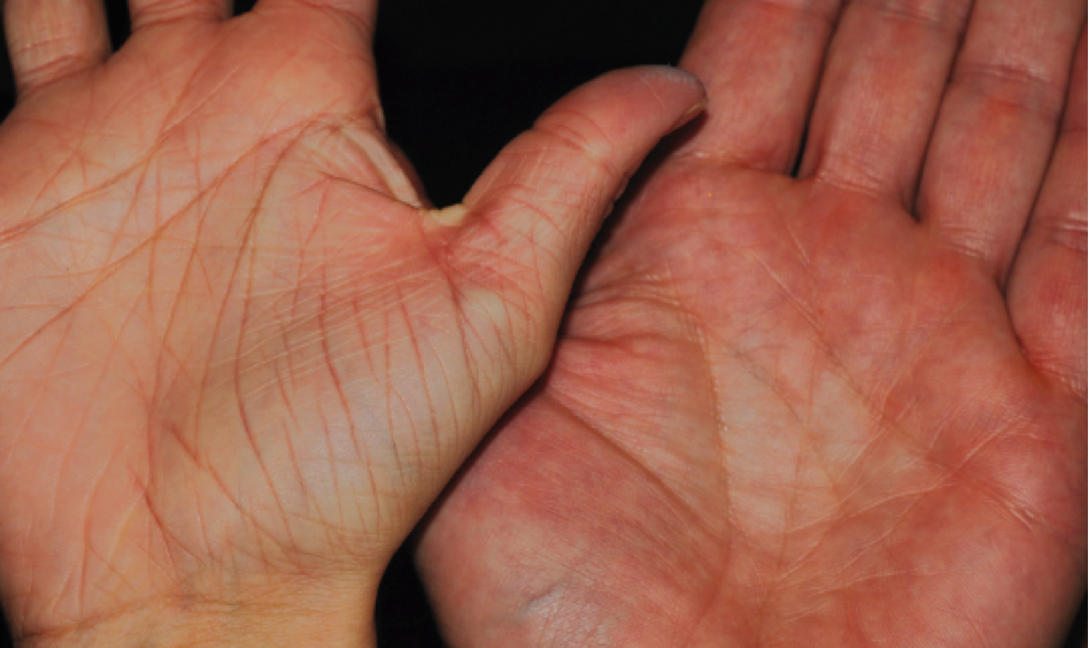 Can You Determine Age from a Hand Comparison? The Doctor's Channel