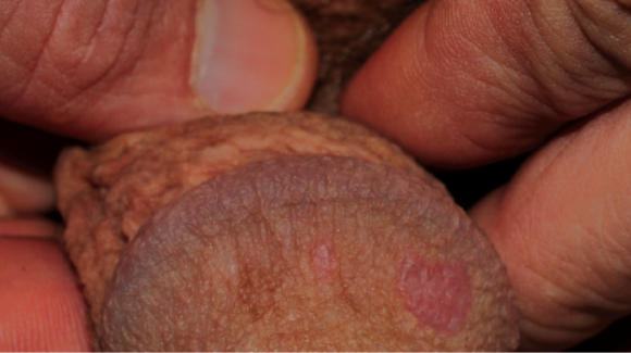 Old Male Penis 10