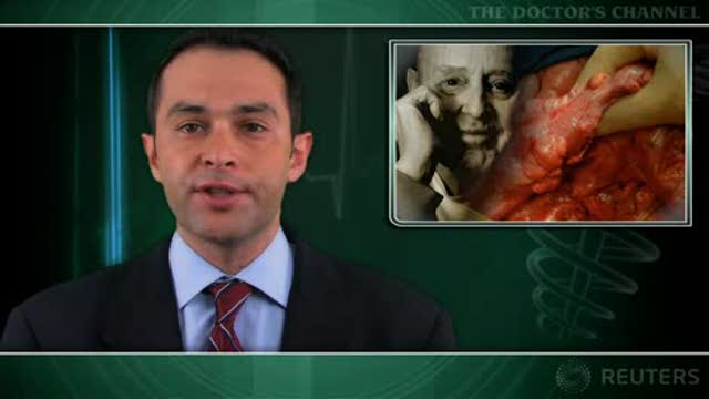Follow-up care lacking for many older colon cancer survivors Thumbnail
