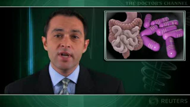 PPI therapy a risk factor for C. difficile diarrhea in hospitalized patients Thumbnail