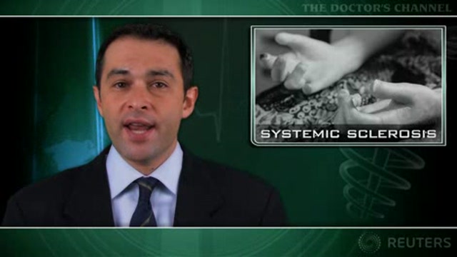 Statins may be useful for systemic sclerosis manifestations Thumbnail