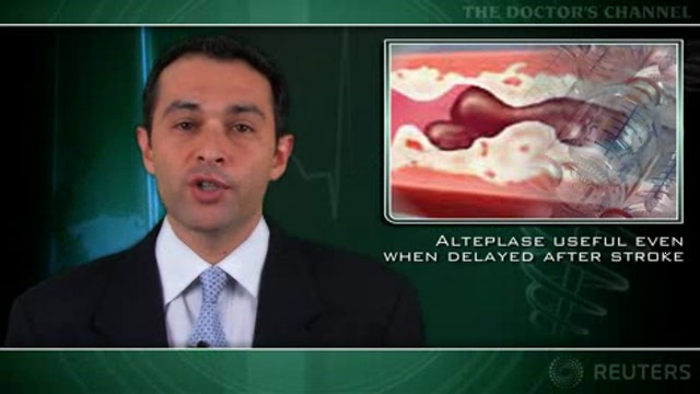 Alteplase useful even when delayed after stroke Thumbnail