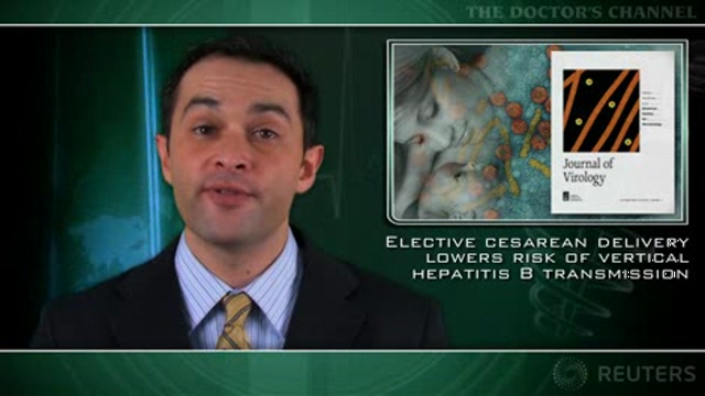 Elective cesarean delivery lowers risk of vertical hepatitis B transmission Thumbnail