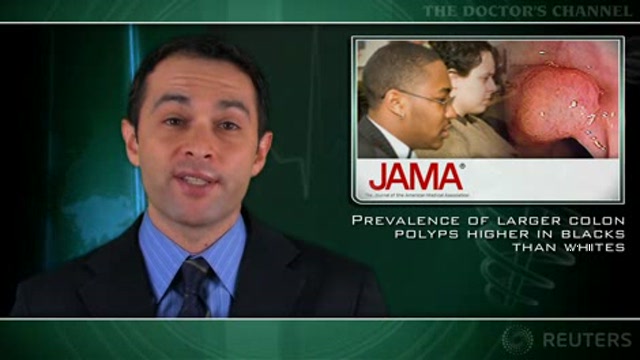 Prevalence of larger colon polyps higher in blacks than whites Thumbnail