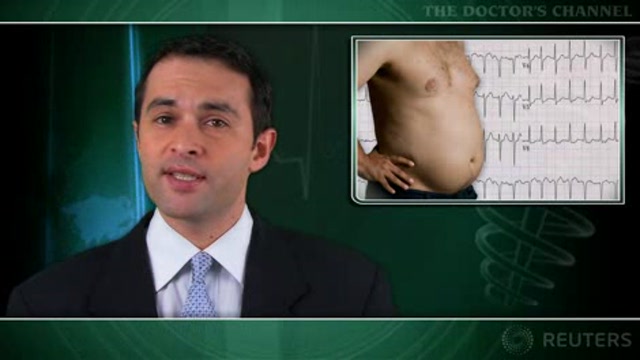 Obesity may raise risk of progression to permanent atrial fibrillation Thumbnail