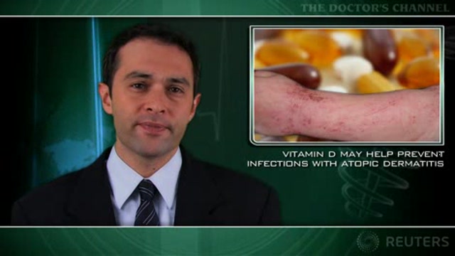 Vitamin D may help prevent infections with atopic dermatitis Thumbnail