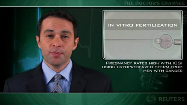 Pregnancy rates high with ICSI using cryopreserved sperm from men with cancer Thumbnail