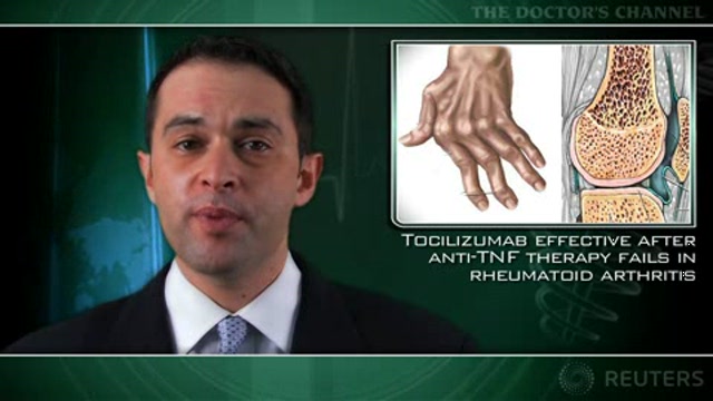 Tocilizumab effective after anti-TNF therapy fails in rheumatoid arthritis Thumbnail