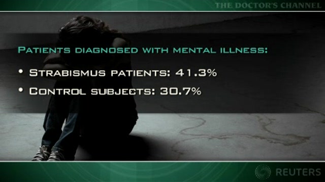 Strabismus in childhood linked to risk of mental illness in young adulthood Thumbnail