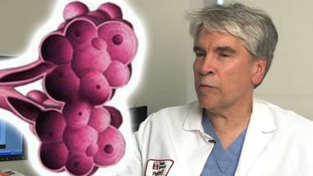 Treating Emphysema with Lung Volume Reduction Surgery Thumbnail