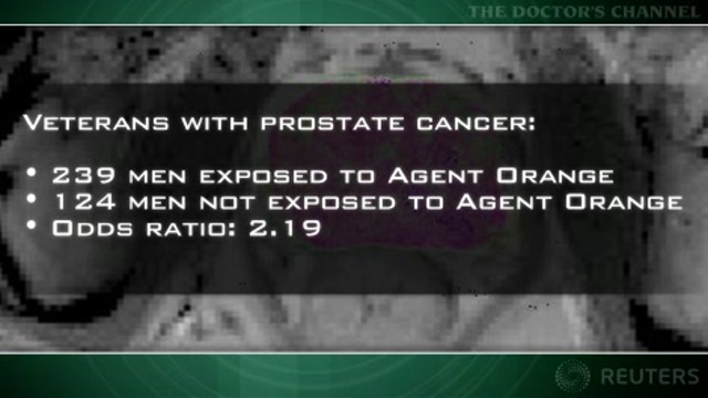 Agent Orange exposure linked to doubled risk of prostate cancer Thumbnail