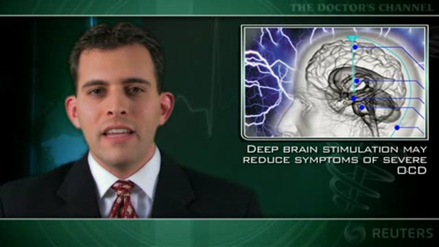 Deep brain stimulation may reduce symptoms of severe OCD Thumbnail