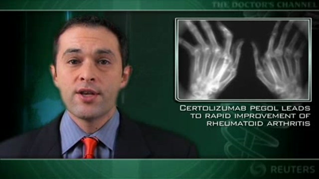 Certolizumab pegol leads to rapid improvement of rheumatoid arthritis Thumbnail