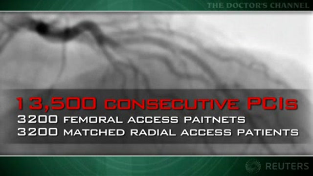 Transradial approach reduces PCI complications Thumbnail