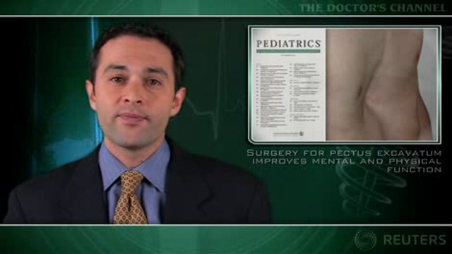 Surgery for pectus excavatum improves mental and physical function Thumbnail