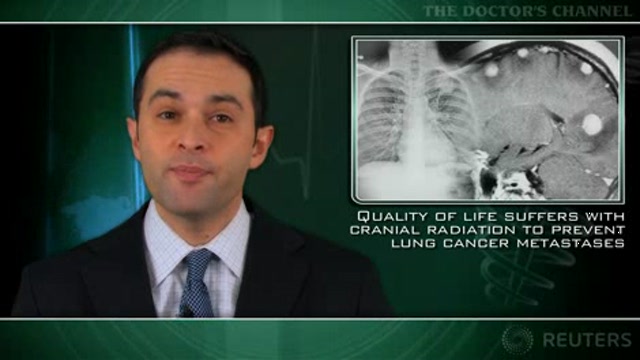 Quality of life suffers with cranial radiation to prevent lung cancer metastases Thumbnail